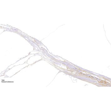 Искусственный Камень агломерат Avant Quartz 7030 Калакатта Шенонсо